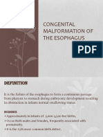 Malformations of Oesophagus