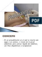 Paracentesis Abdominal