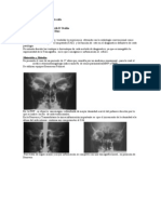 Diagnostico Por Imagenes de Oido