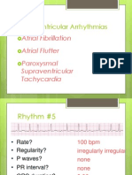 Atrial Flutter