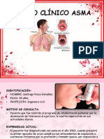Caso Clínico Asma