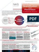 Quantification Prevention: Focus On