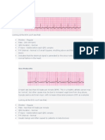 Ecg Readings