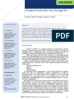 Reimplantation of Avulsed Teeth After Dry Storage For One Week
