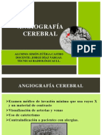 Angiografía Cerebral Final