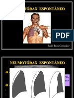 NEUMOTÓRAX