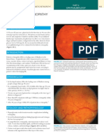 Diabetic Retinopathy