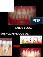 Índice de Higiene Bucal