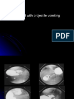 6th y Abdomen X-Ray