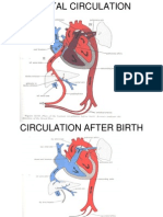 Atrial Septial Defect