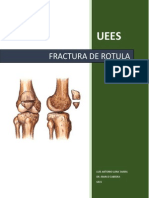 Fractura de La Rótula