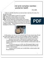 Compound and Complex Cavities On Posterior Teeth: Cons Lec 6 5.11.08