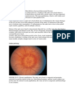 The Optic Nerve