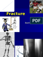 Fracture 01