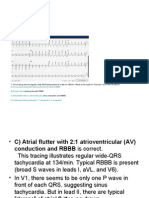 Kyuhyun Wang, MD: What Is The Rhythm?