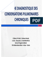 Condensations Alveolaires