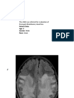 Leukodystrophies and Mucopolysacridosis