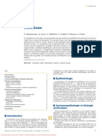 Chordome PDF