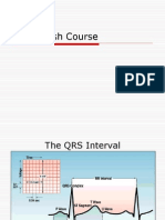 EKG Crash Course NuRsing 390 SMC - 4