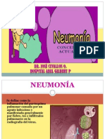 5 - Neumonia