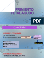 Sufrimiento Fetal Agudo