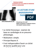 La Lecture D'une Radiographie Thoracique