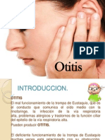 Otitis