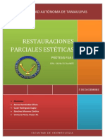 Restauraciones Parciales Esteticas