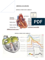 ARRITMIAS