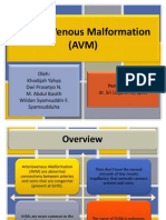 Arterio Venous Malformation