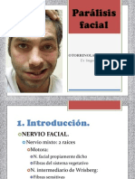 Parálisis Facial