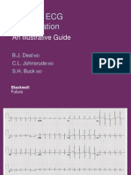 Atlas ECG PPT2