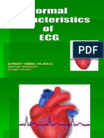 Normal Characteristics of Ecg