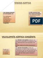 Estenosis Aortica, Mitral y Pulmonar