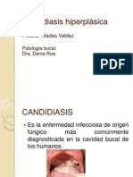 Candidiasis Hiperplasica