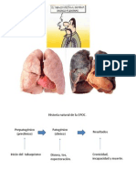 EPOC Prevencion Terciaria