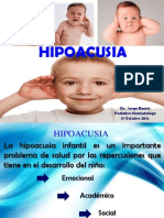 HIPOACUSIA 