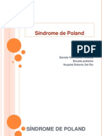 Sindrome de Poland