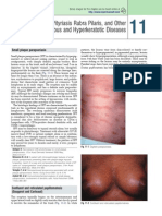 Chapter 11 Pityriasis Rosea, Pityriasis Rubra Pilaris, and Other Papulosquamous and Hyperkeratotic Diseases