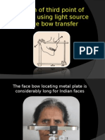 Face Bow Transfer