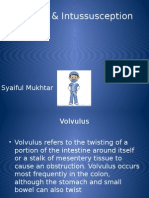 Volvulus & Intussuseption