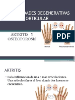 Enfermedades Degenerativas Orticular