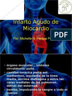 Infarto Agudo de Miocardio 