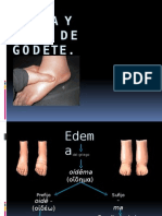 Edema y Signo de Godet