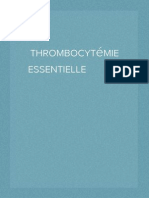 Thrombocytémie Essentielle