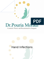 Hand Infections