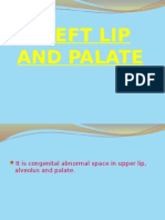 Cleft Lip and Palate Presentation