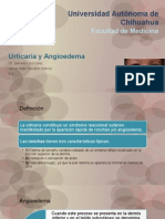 Urticaria