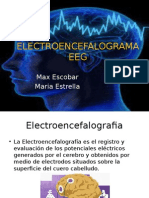 Electroencefalograma (EEG)