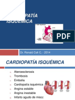 Cardiopatia Isquemica